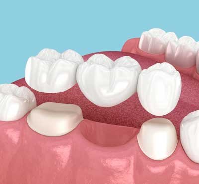 Dental Examination