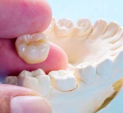 Dental Examination