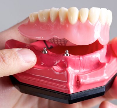 Dental Examination