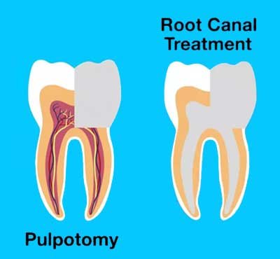 Dental Examination